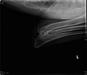 Left Elbow X-ray